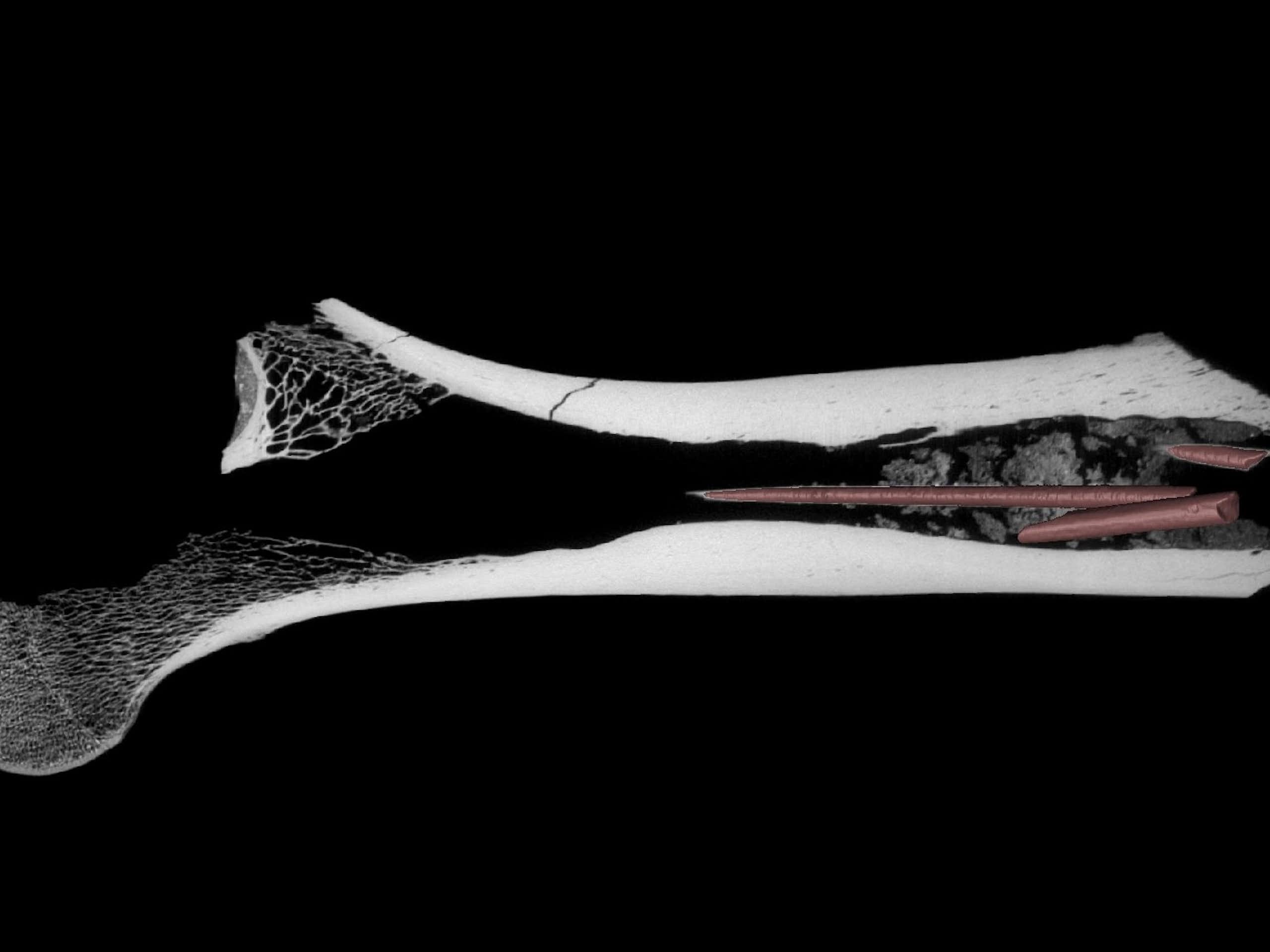 A 3D rendering of a femur bone. 